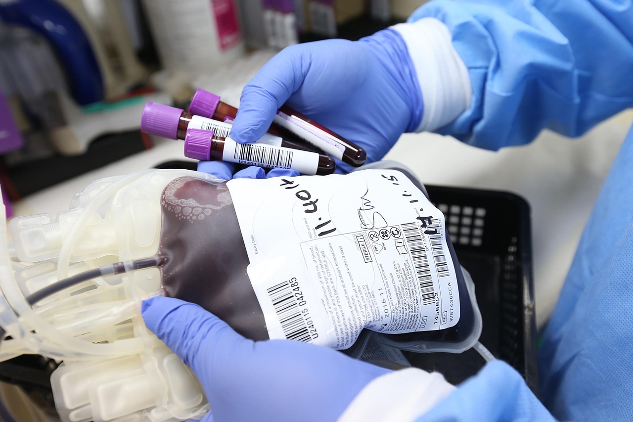 fotografia simbolo di una sacca di sangue in un centro trasfusionale
